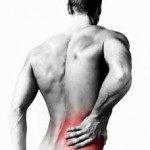 La Sciatica